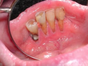 Dscn4820 d7gcjy - Eugenol