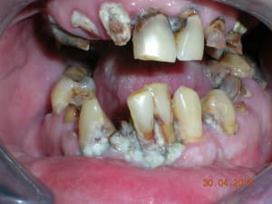 Dscn5025 akrf2a - Eugenol