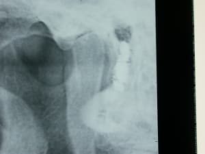 Dscn6940 s6sv5g - Eugenol