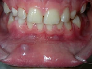 Dscn8297 yemxbi - Eugenol