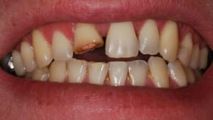 Dsc 0001 1  640x480  y8oygs - Eugenol