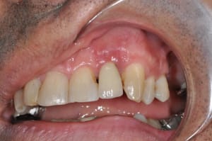 Dsc 0001 bnkk9k - Eugenol