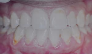 Dsc 0002 rvdtma - Eugenol