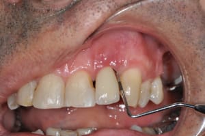 Dsc 0003 qvgrpt - Eugenol