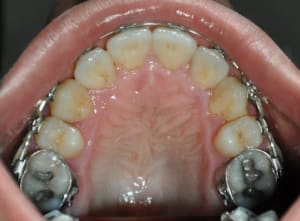 Dsc 0005 jd868h - Eugenol
