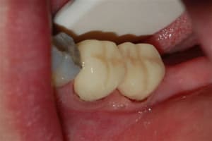 Dsc 0007 pbzkan - Eugenol