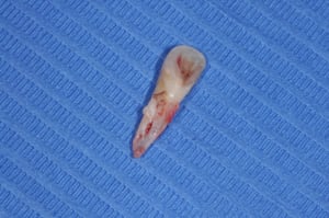 Dsc 0013 ynzgkk - Eugenol