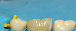 Dsc 0019 ymheyq - Eugenol