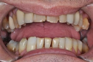 Dsc 0041 je96ca - Eugenol