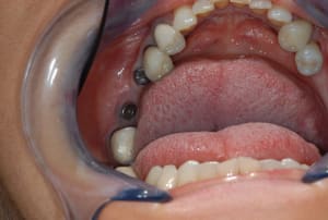 Dsc 0047 bmfwyb - Eugenol