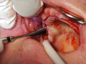 Dsc 0078 rjvlyc - Eugenol