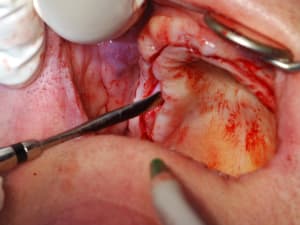 Dsc 0079 fu9aui - Eugenol