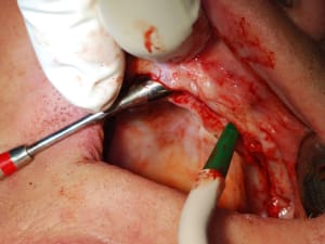 Dsc 0093 fddy5z - Eugenol