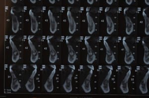 Dsc 0111 k8eigs - Eugenol
