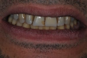 Dsc 0232 sim5hs - Eugenol