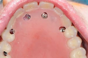 Dsc 0273 htb4bw - Eugenol