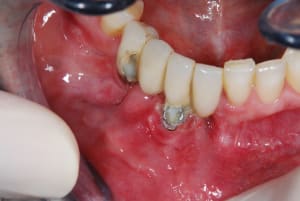 Dsc 0293 rx73hw - Eugenol