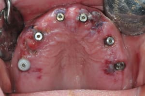 Dsc 0312 f6teo2 - Eugenol