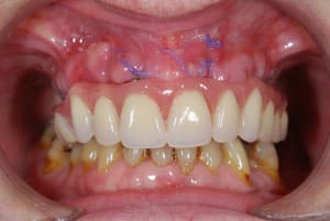 Dsc 0335 tqqh2y - Eugenol