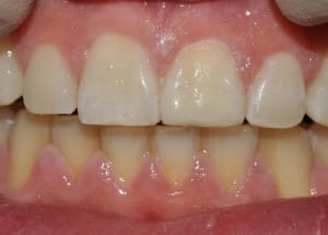 Dsc 0371 vzjaw6 - Eugenol