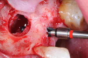 Dsc 0395 qdppe1 - Eugenol