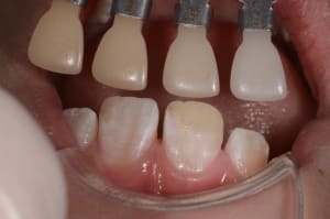 Dsc 0511 fqprrg - Eugenol