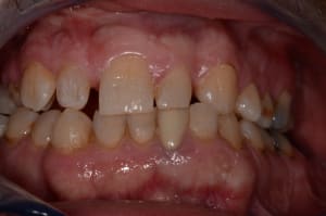 Dsc 0531 jvz7r9 - Eugenol