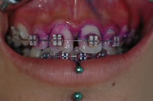 Dsc 0531 lqrvgj - Eugenol