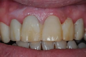 Dsc 1145 gluyca - Eugenol