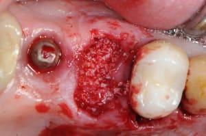 Dsc 1553 sm0uub - Eugenol