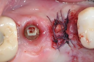 Dsc 1555 pqy7pq - Eugenol