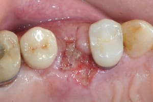 Dsc 1676 tbx0co - Eugenol