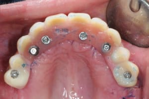 Dsc 1932 umfsja - Eugenol