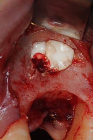Dsc 2127 xniugy - Eugenol