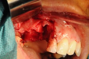 Dsc 2452 u29una - Eugenol