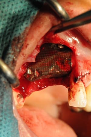 Dsc 2465 qbt6ac - Eugenol