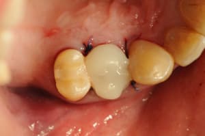 Dsc 2608 hbk1fy - Eugenol