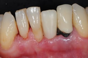 Dsc 2678 sl5k8e - Eugenol