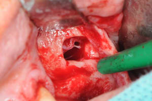 Dsc 2821 cnewpl - Eugenol