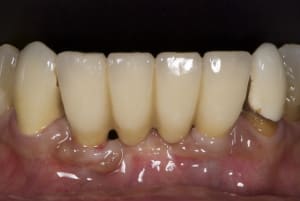 Dsc 3473 y3imdm - Eugenol
