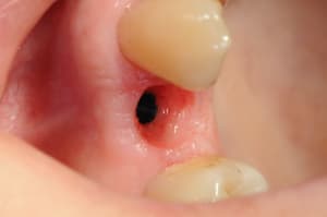 Dsc 3866 edldnh - Eugenol