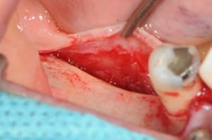 Dsc 4003 qfbqkn - Eugenol