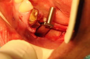 Dsc 4059 h9iide - Eugenol