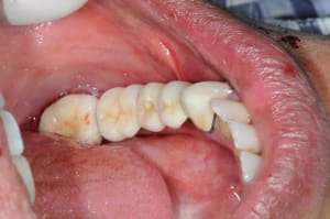 Dsc 4078 bv1hmu - Eugenol