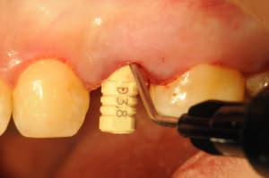 Dsc 4119 kjdb9r - Eugenol