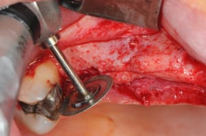 Dsc 4559 dpqagz - Eugenol
