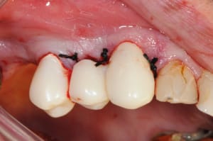 Dsc 5095 wmygak - Eugenol