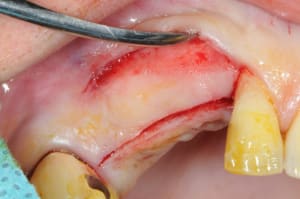 Dsc 5214 bu3gwb - Eugenol