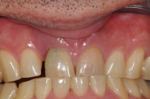 Dsc 5620 i4xdsp - Eugenol