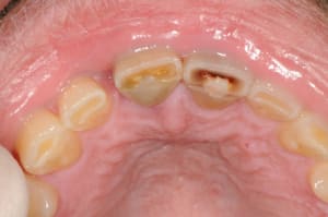 Dsc 5621 cpdqfk - Eugenol